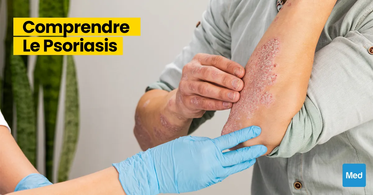 Comprendre le Psoriasis : Démystification d'une Maladie Courante
